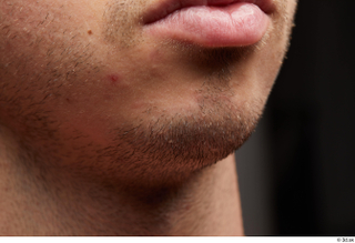 HD face Skin Joel cheek chin face lips mouth skin…